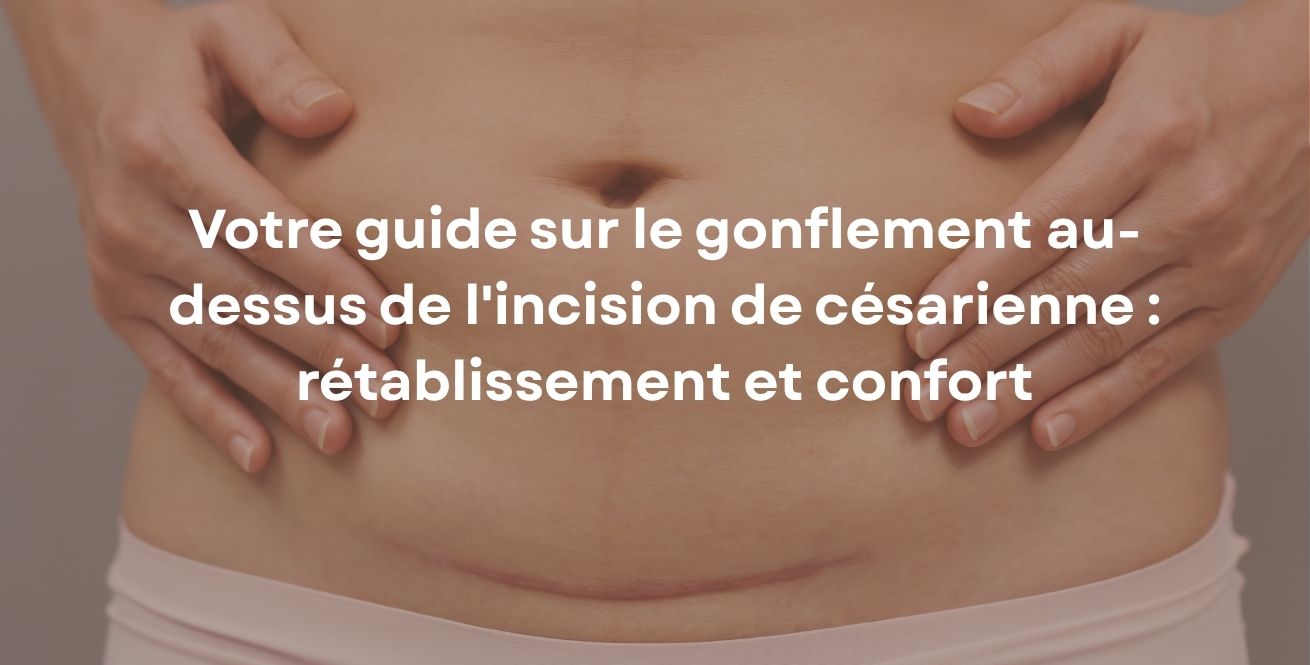 Votre guide sur le gonflement au-dessus de l'incision de césarienne : rétablissement et confort