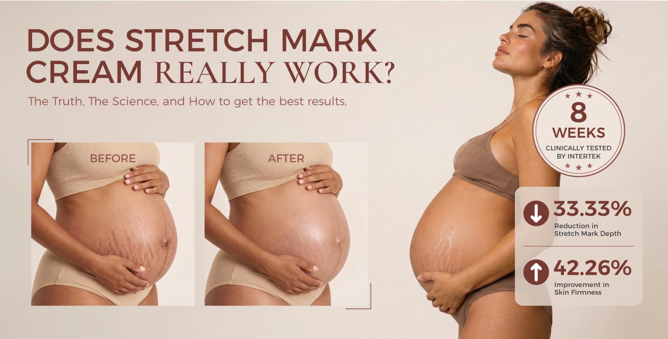 Does Stretch Mark Cream Really Work?