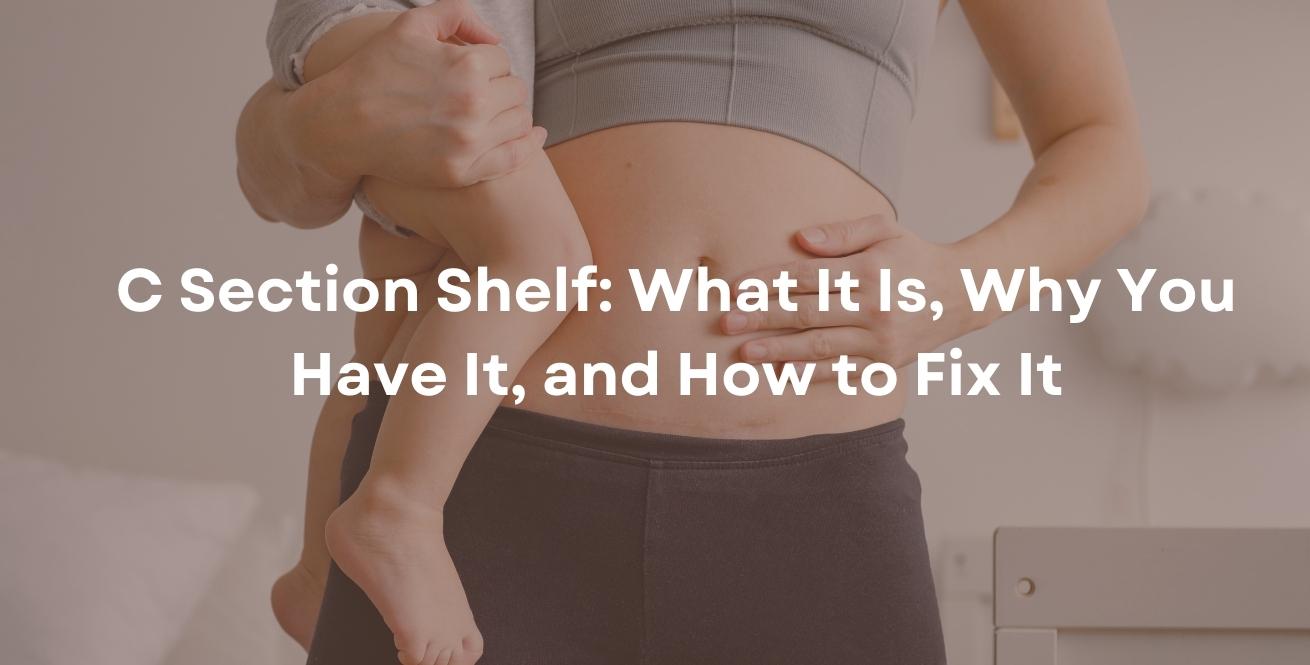 C Section Shelf: What It Is, Why You Have It, and How to Fix It