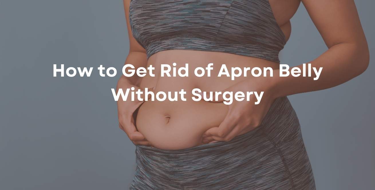 How to Get Rid of Apron Belly Without Surgery